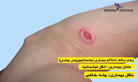 پشه ها و خطر انتقال بیماری های مختلف 8 علائم بیماری لیشمانیازیس