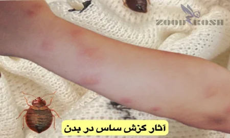 معظلی بنام ساس و راهکارهای ریشه کنی آن 3 از بین بردن ساس با ضمانت در تهران