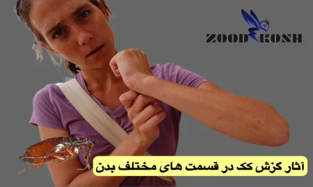 آشنایی با کک ها (Fleas) 3 سمپاشی کک در تهران با ضامنت