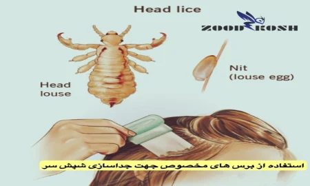 آلودگی با شپش سر، بدن و عانه 5 راه های کنترل شپش سر