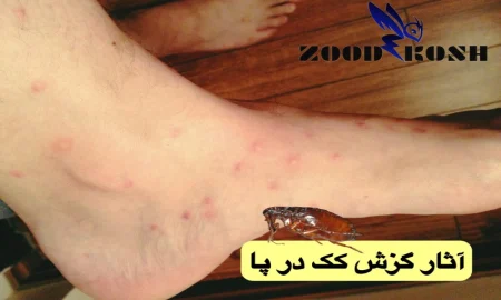 آشنایی با کک ها (Fleas) 4 علائم و راه های از بین بردن کک